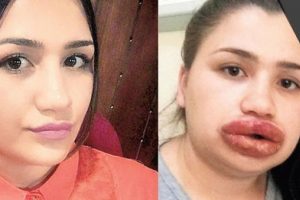 Uzman, kuaf&ouml;r &ccedil;ıktı! Gen&ccedil; kızın hayatı karardı