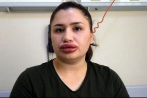 Hemşireyi bu hale getiren kuaf&ouml;r hakkında su&ccedil; duyurusu