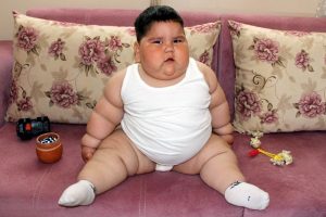 1,5 yaşında 32 kilo olan bebek yardım bekliyor