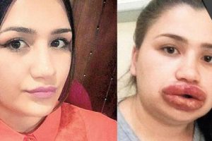 Sahte estetik uzmanı kuaf&ouml;re bir soruşturma daha