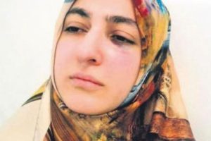 Diş hekimini 'dişimi acıttın' diyerek yumrukladı