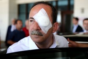 Selfie &ccedil;ekerken belediye başkanına saldırı