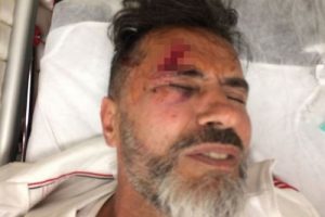 Yaşar Alptekin trafik kazası ge&ccedil;irdi