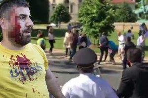 ABD'den o kavgayla ilgili a&ccedil;ıklama geldi