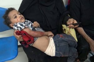 Yemen'de &ccedil;atışma: 6 &ouml;l&uuml;, 20 yaralı