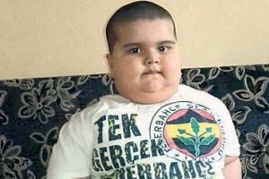 2,5 yaşında ve tam 50 kilo; ailesi 15 bin liralık ilaç masrafı için SGK'dan yardım istiyor