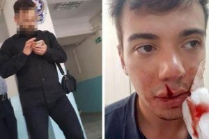 &Ouml;ğretmen beyzbol sopası ile dehşet sa&ccedil;tı!