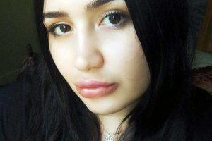 Silikon mağduru hemşire son halini paylaştı