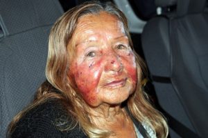 90 yaşındaki kadın gasp&ccedil;ının elinden cinsel organını sıkarak kurtuldu!