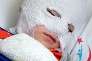 5 yaşındaki &ccedil;ocuk yaktığı ateşin i&ccedil;ine d&uuml;şt&uuml;
