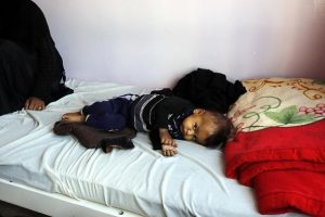 Yemen'deki kolera salgınının bilan&ccedil;osu ağırlaşıyor