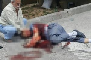Eski damat dehşet sa&ccedil;tı! 13 yerinden bı&ccedil;akladı