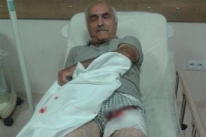 Ayının saldırısına uğrayan inşaat ustası yaralandı