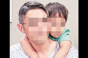 Şişli Etfal'de ameliyat sırasında kal&ccedil;asını yaktılar