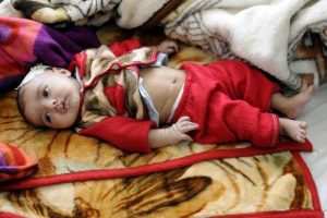 UNICEF: Yemen'de 10 milyon &ccedil;ocuk acil yardıma muhta&ccedil;