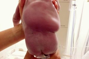 Anne karnındaki bebek hayat kurtardı