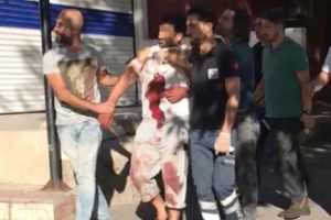 Eşini ve kızını yaralayan baba 1.5 saat sonra polise teslim oldu
