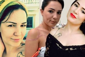 D&ouml;vme yaptıran kızın hayatını kararttılar