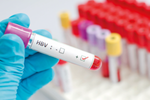 Uzmanlardan hepatitin bulaşma yolları ve tedavi uyarısı