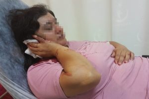 Emekli astsubay karısını kafasından bı&ccedil;akladı!