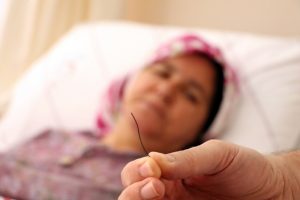 Petek bal yedi, midesinden 10 santim tel &ccedil;ıktı
