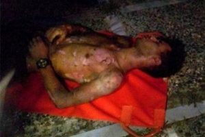 Vagon &uuml;zerinde selfie yapan gen&ccedil; akıma kapıldı