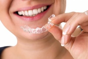 Invisalign tedavisiyle ilgili bilinmesi gereken 12 nokta