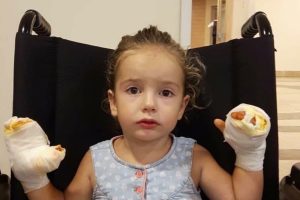Bursa'da uçan balon faciası! Küçük çocuğun elleri yandı