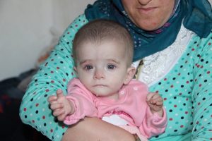 Kanser hastası 10 aylık Alime'nin bakışları y&uuml;rek yakıyor