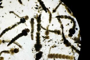 Zika vir&uuml;s&uuml; beyin kanserinin tedavisinde kullanılabilir