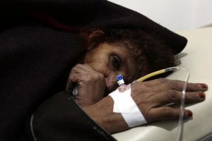 Yemen'deki kolera salgınında 2 bin 101 kişi hayatını kaybetti