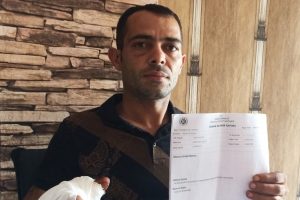 Alkol şişesi elinde patladı