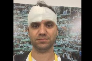 Bursaspor ma&ccedil;ında basın mensubunun başı yaralandı