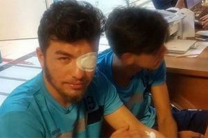 Takım otob&uuml;s&uuml;ne taşlı saldırıda 5 futbolcu yaralandı