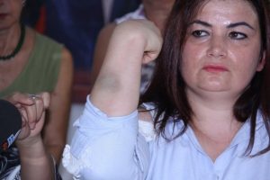 Mersin'de kadın belediye personeline darp iddiası