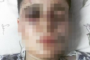 Cinsiyet değiştirmeye &ccedil;alışan gen&ccedil;ten parkta dayak iddiası