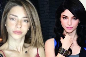 Merve Boluğur estetik mi yaptırdı?