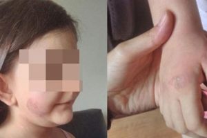 &Ccedil;ocuğuna işkencede babaya 11.5 yıl hapis istendi