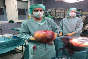 İkiz bebek sandılar, bu &ccedil;ıktı