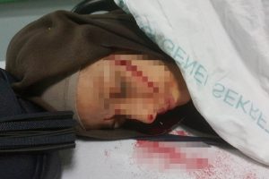 Eski koca dehşeti: 1'i ağır 2 yaralı