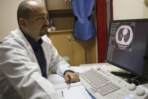 Akciğer kanserinde 'mavi boya' ile erken teşhis