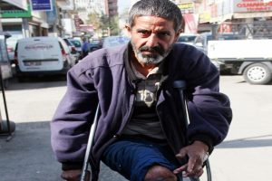 Engellinin protez bacağını &ccedil;aldılar