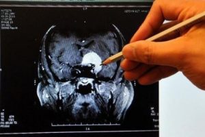 İstenmeyen d&uuml;ş&uuml;nceler i&ccedil;in kimyasal bulundu