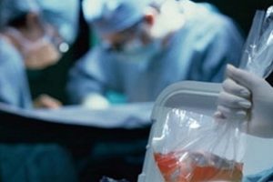 'T&uuml;rkiye'de 25 bin hasta organ nakli bekliyor'