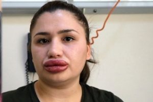 "Sahte estetik uzmanı"na 6 yıl hapis cezası