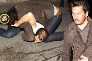 R&uuml;zgar &Ccedil;etin'in y&uuml;z&uuml;ndeki iz incelenecek!
