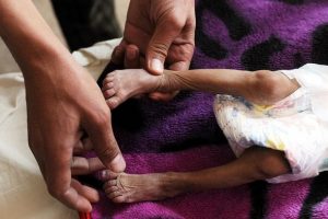 Yemen ablukası &uuml;&ccedil;&uuml;nc&uuml; haftasında