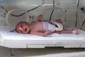 Karnından 1 kilo 300 gram kitle &ccedil;ıkarıldı