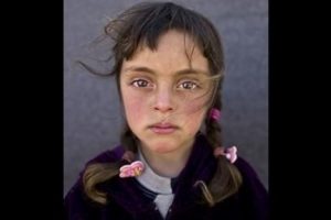 Yılın fotoğrafının kahramanı Suriyeli Zehra oldu