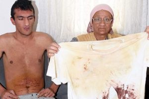 Engelli genci başına &ccedil;uval ge&ccedil;irip d&ouml;vd&uuml;ler, bı&ccedil;akla yaraladılar